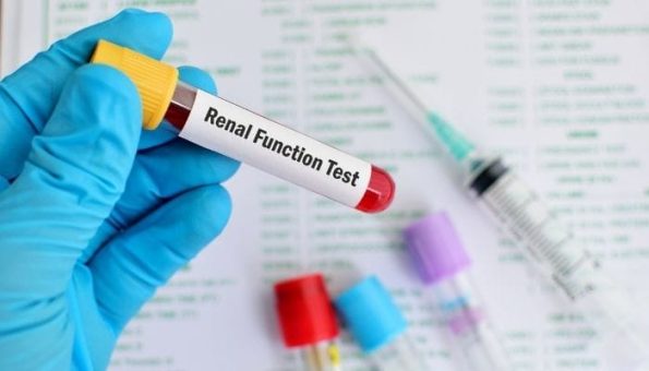 Renal Function Test (RFT) - Dr. Lal Pathlabs