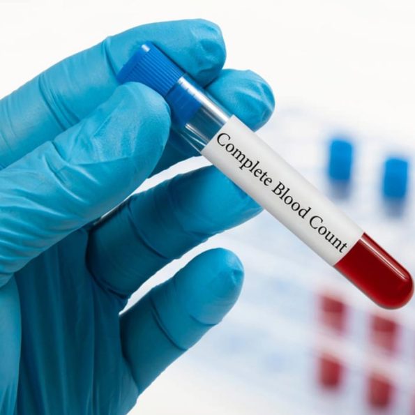 CBC - Biogene Labs