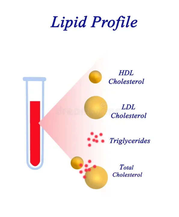 LIPID PROFILE - Dr. Lal Pathlabs