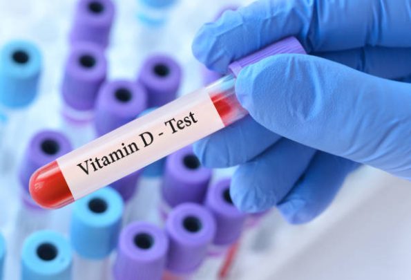 VIT-D3 - Dr. Lal Pathlabs