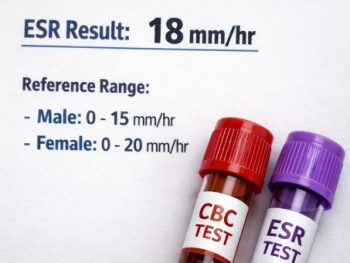 cbc with esr https://medigolife.com