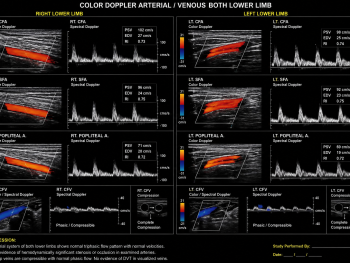 Color Doppler Arterial / Venous Both Limb https://medigolife.com