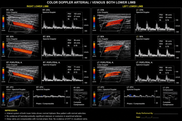Color Doppler Arterial / Venous Both Limb - Radiant Ultrasound