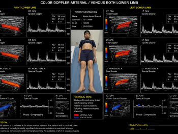 Color Doppler Arterial / Venous Both Limb https://medigolife.com