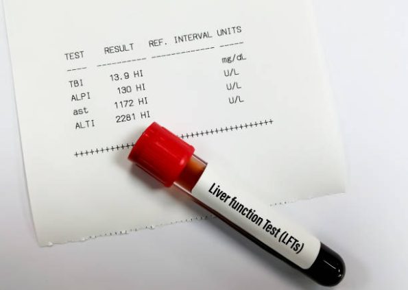 Liver Function Test (LFT) - Dr. Lal Pathlabs